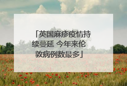 英国麻疹疫情持续蔓延 今年来伦敦病例数最多